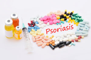 Medicine-for-Psoriasis-treatment